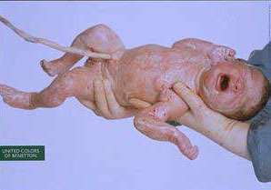 olivier-toscani-newborn-baby-for-benetton-ad-2